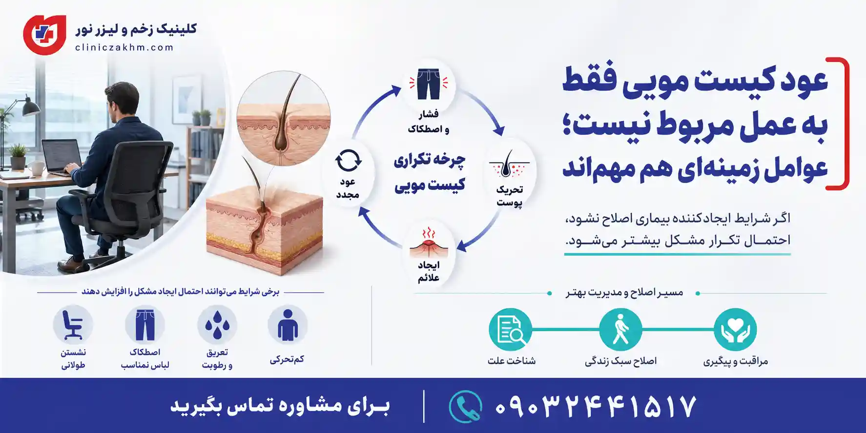 درمان قطعی کیست مویی در مراحل اولیه با لیزر