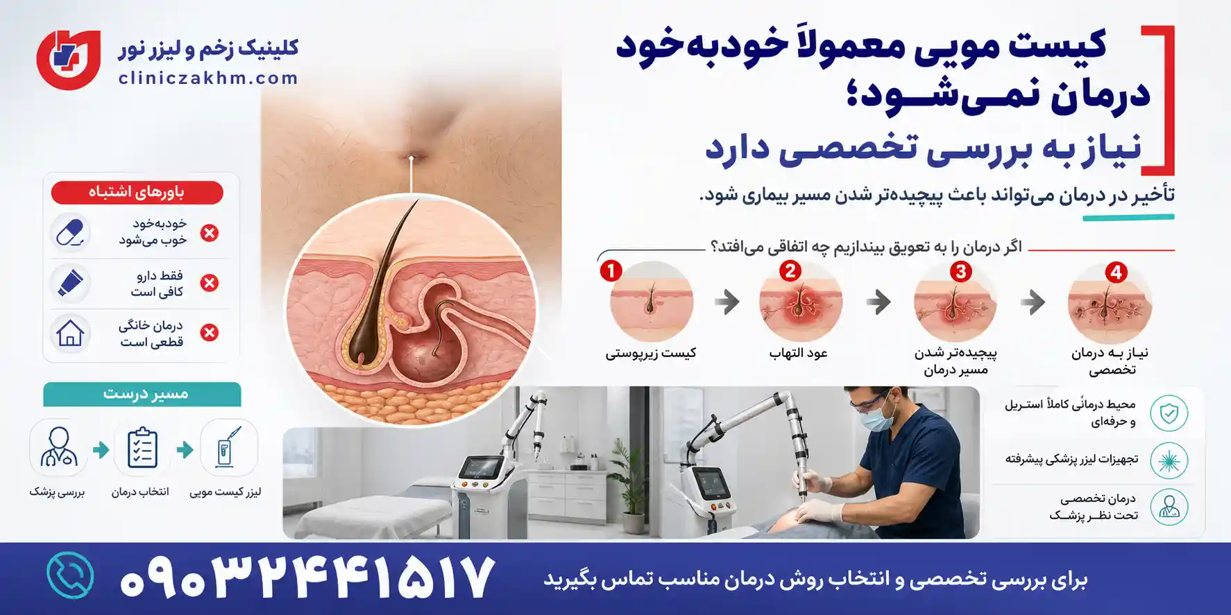 بررسی بهبود خودبه خودی کیست مویی