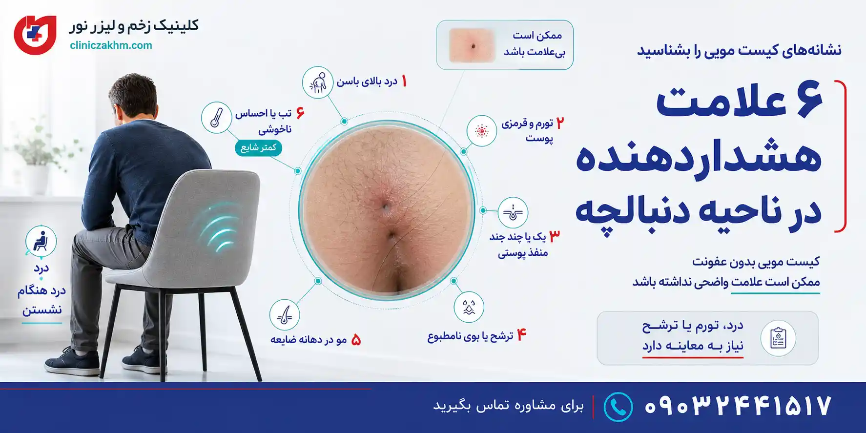 علائم و نشانه‌های کیست مویی