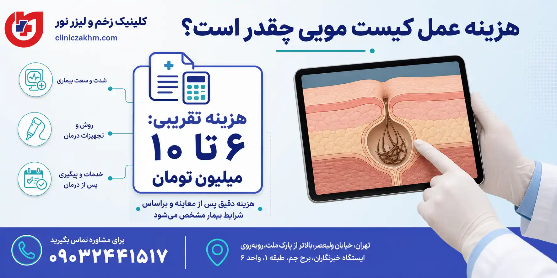 هزینه عمل کیست مویی با لیزر و جراحی سنتی
