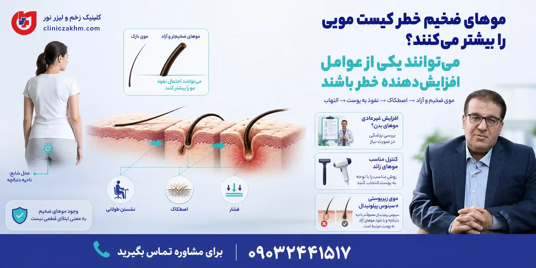 ارتباط موهای ضخیم در زنان با افزایش احتمال ایجاد کیست مویی