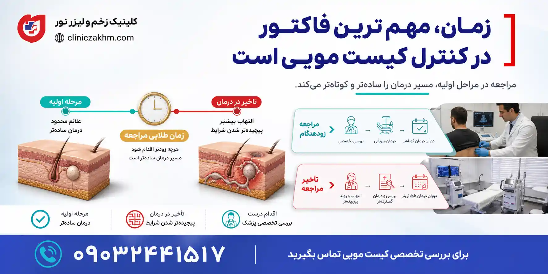 اهمیت زمان در کنترل کیست مویی
