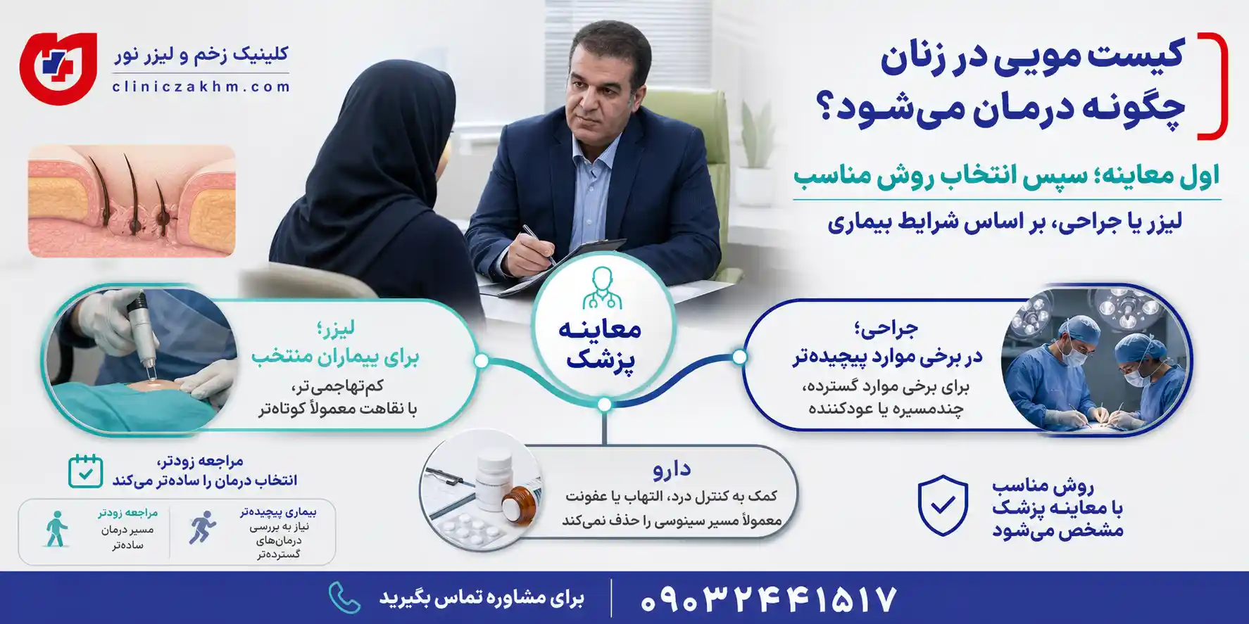 روش های درمان کیست مویی در زنان