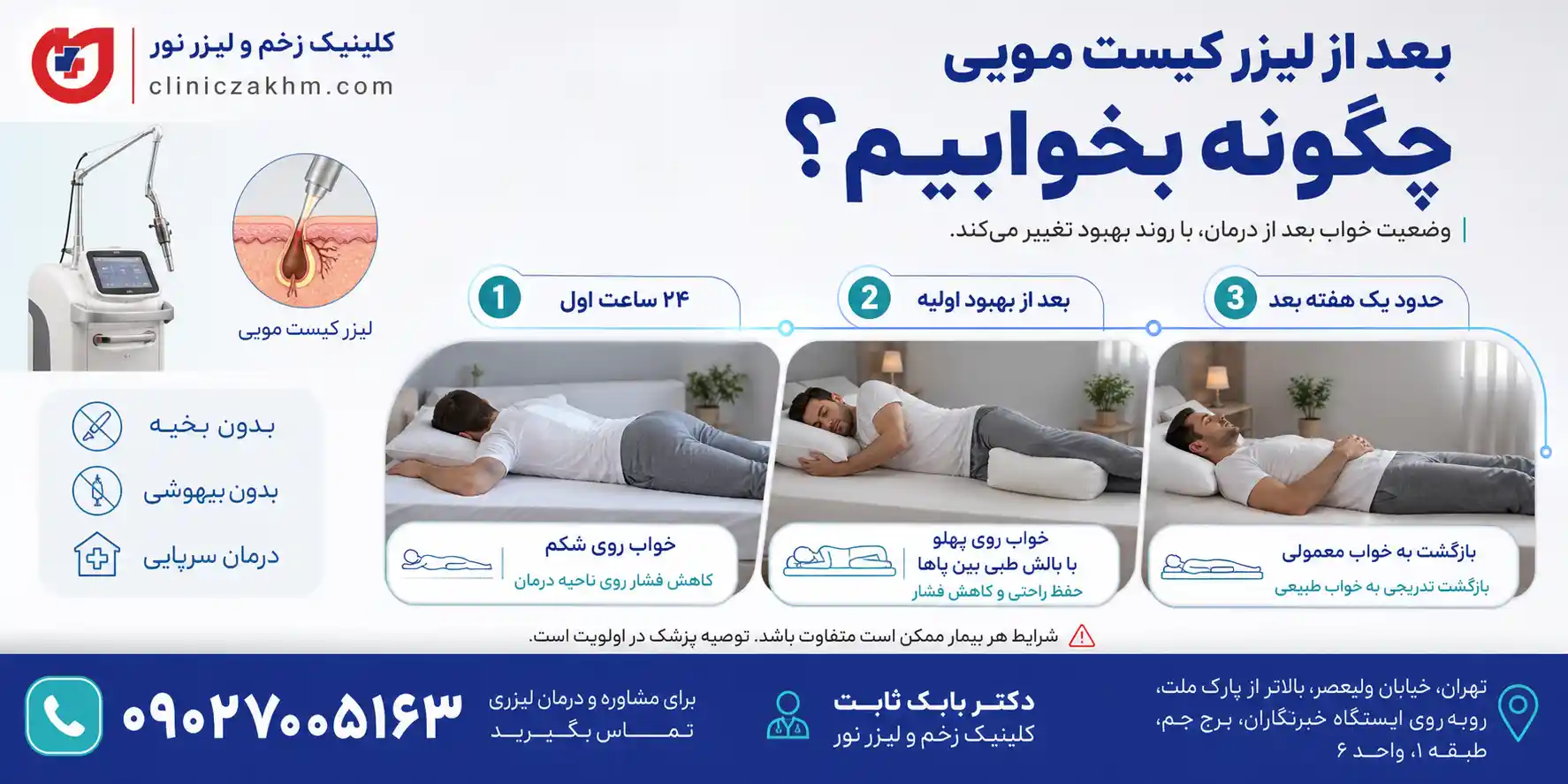 نحوه خوابیدن بعد از عمل لیزر کیست مویی و کاهش فشار روی ناحیه درمان شده