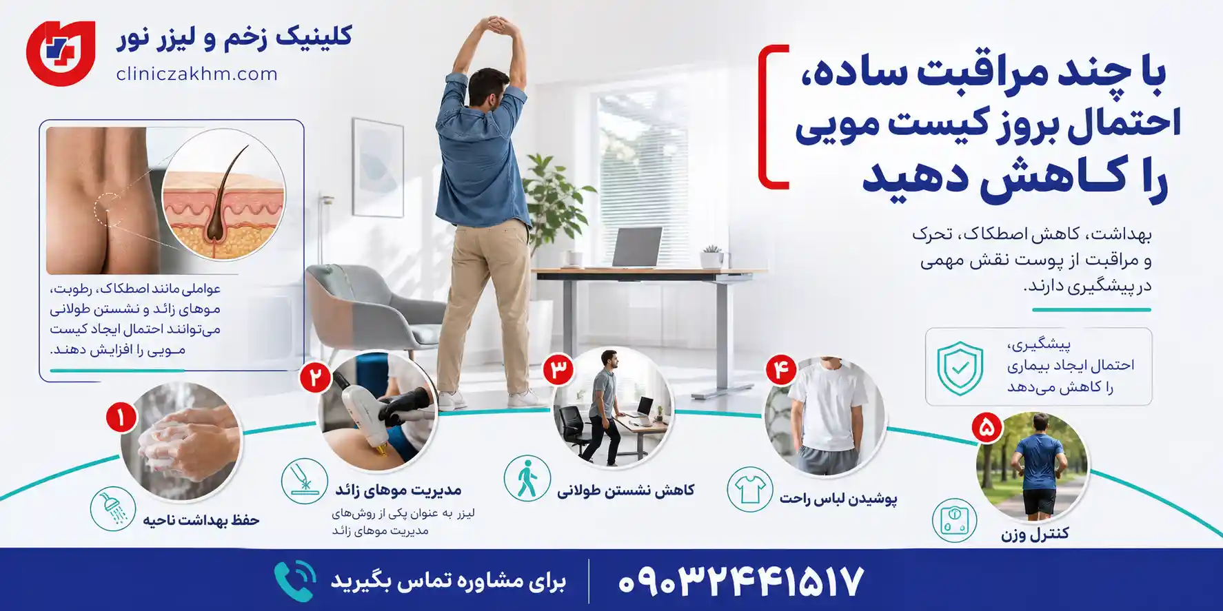 روش های پیشگیری از سینوس پیلونیدال