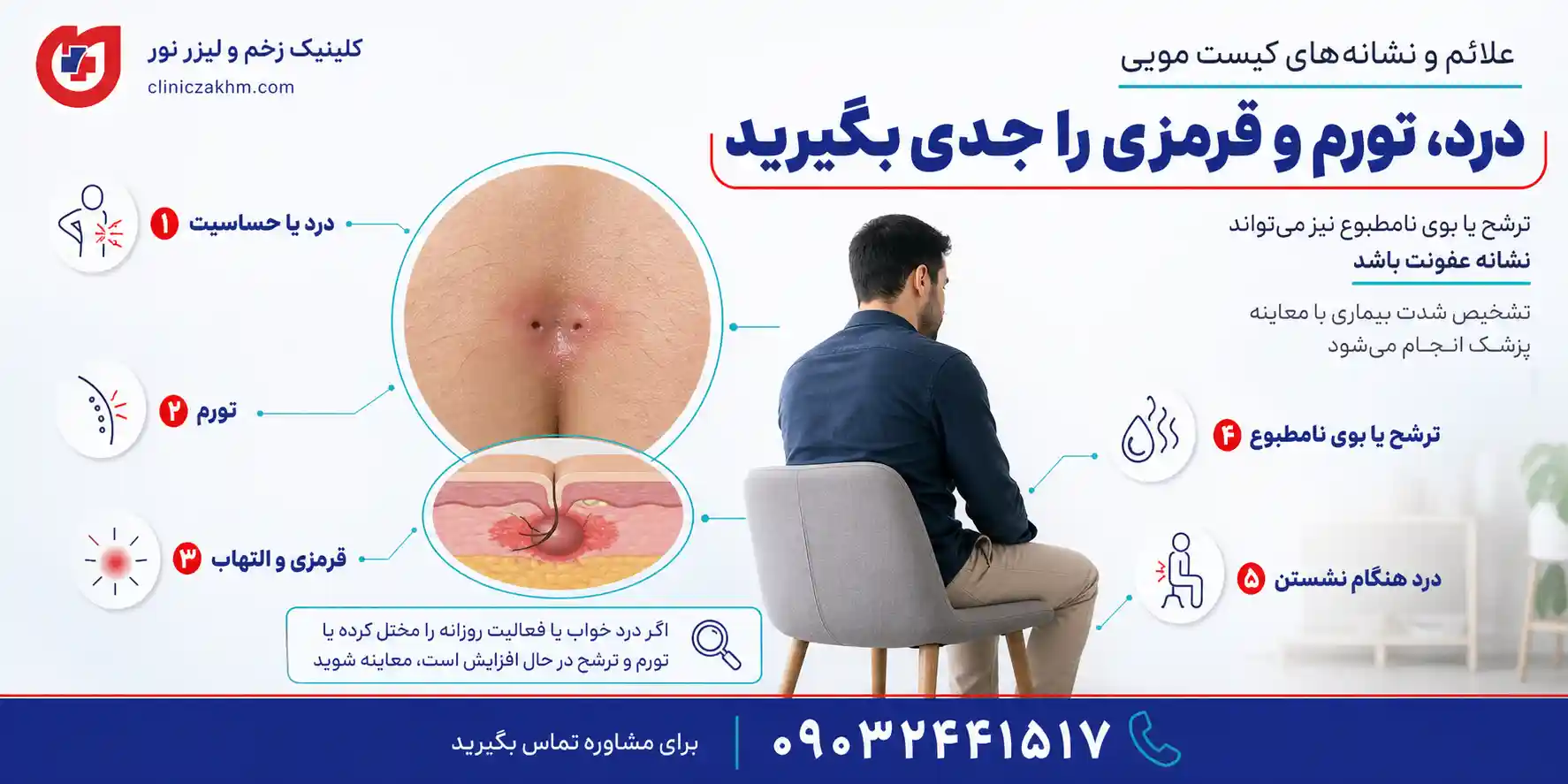 علائم و نشانه‌های کیست مویی