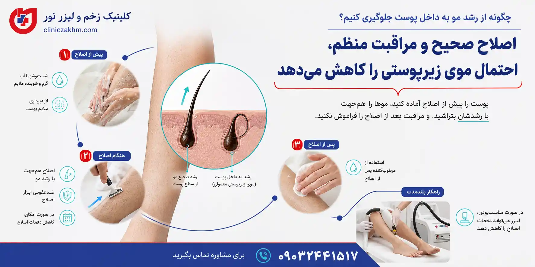 روش‌های جلوگیری از بازگشت مو به داخل پوست