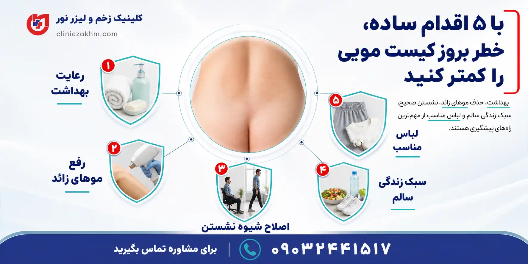 روش های جلوگیری از ایجاد کیست مویی