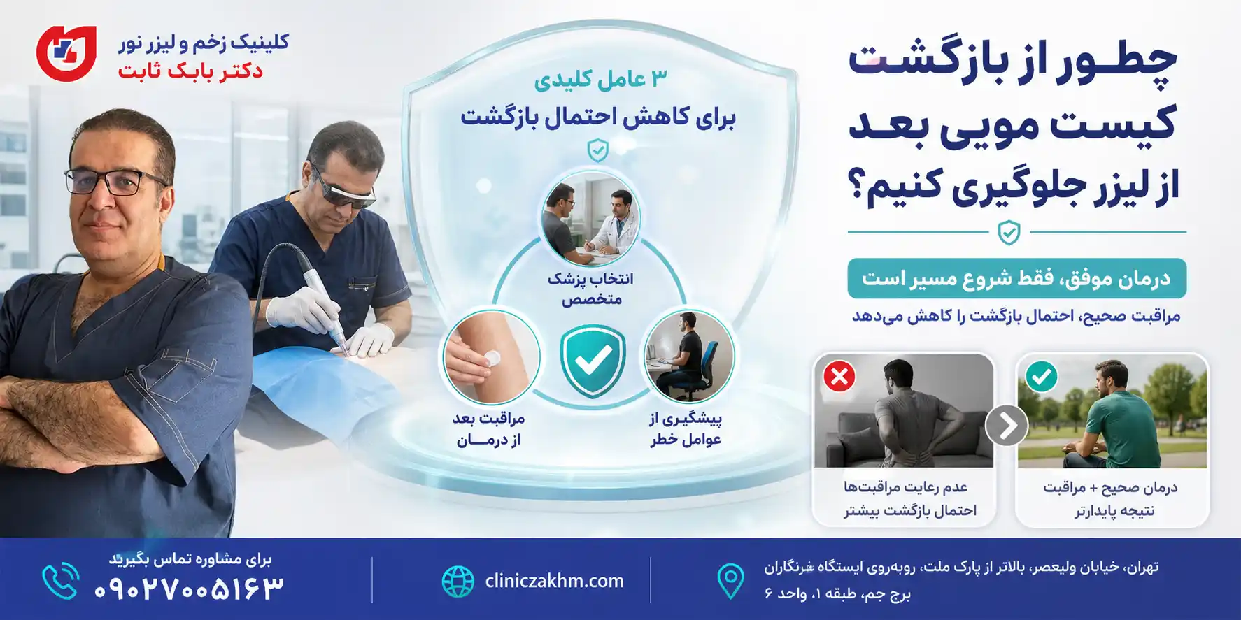 روش های جلوگیری از عود کیست مویی