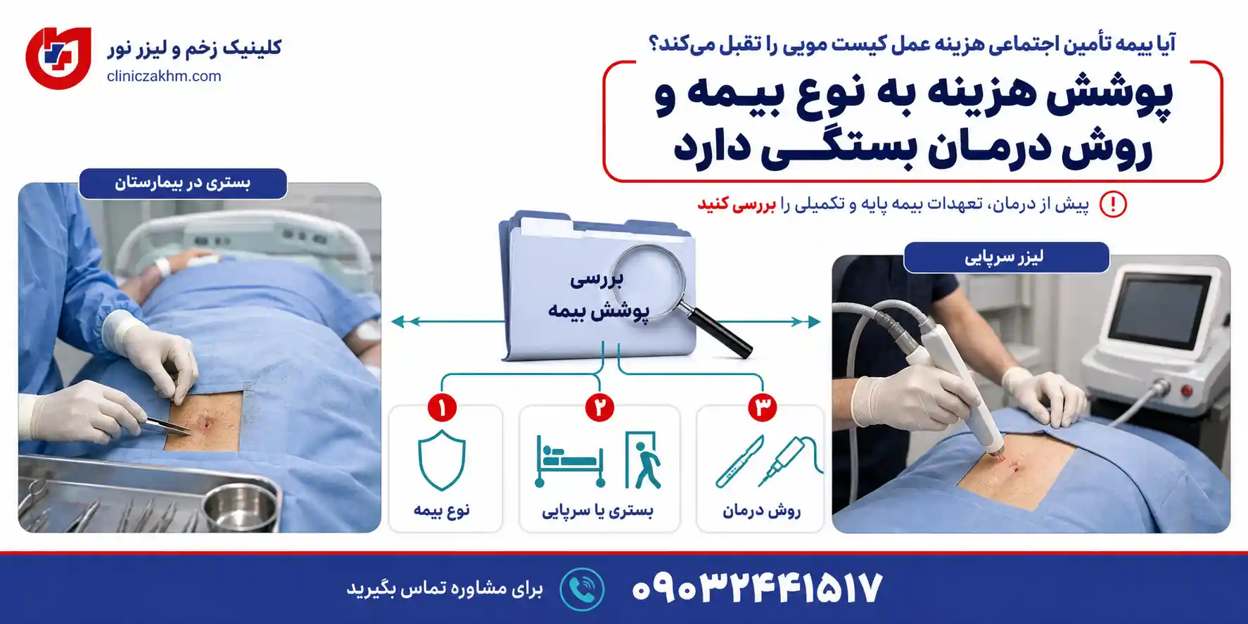 شرایط پوشش بیمه تامین اجتماعی در درمان کیست مویی