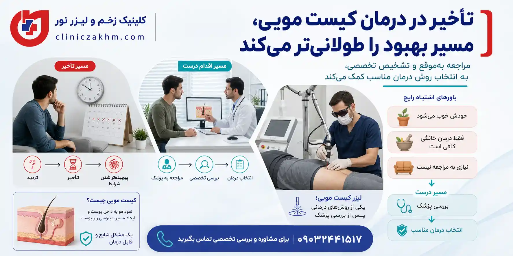 عوارض عمل نکردن کیست مویی