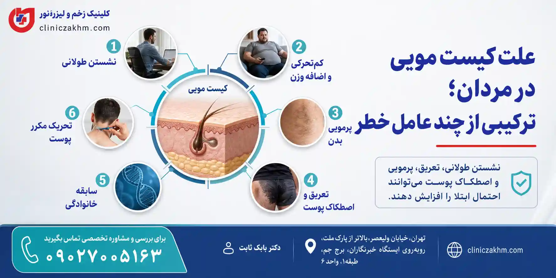 علت ایجاد کیست مویی در مردان و عوامل موثر در بروز سینوس پیلونیدال