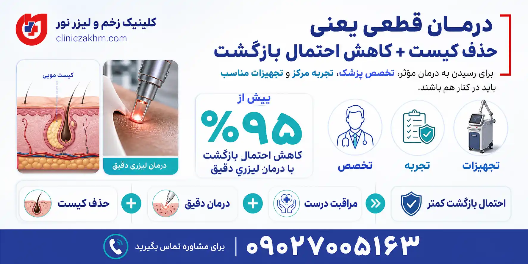 نکات مهم درباره درمان قطعی کیست مویی