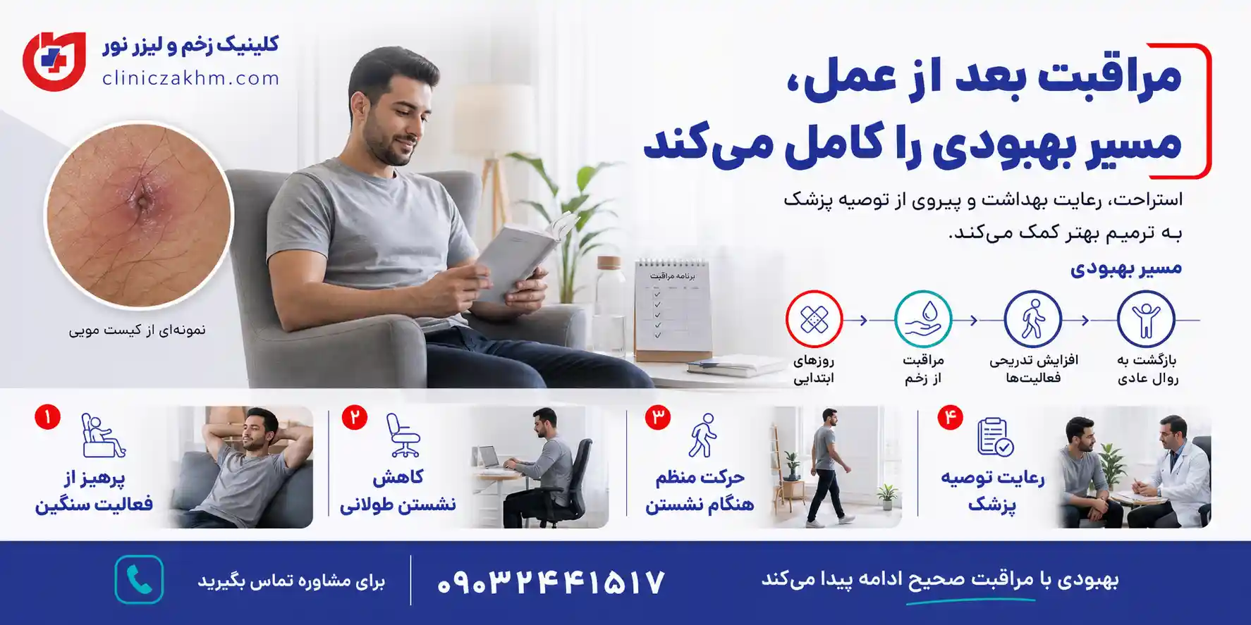 دوران نقاهت بعد از عمل کیست مویی و مراقبت های لازم برای بهبود زخم جراحی
