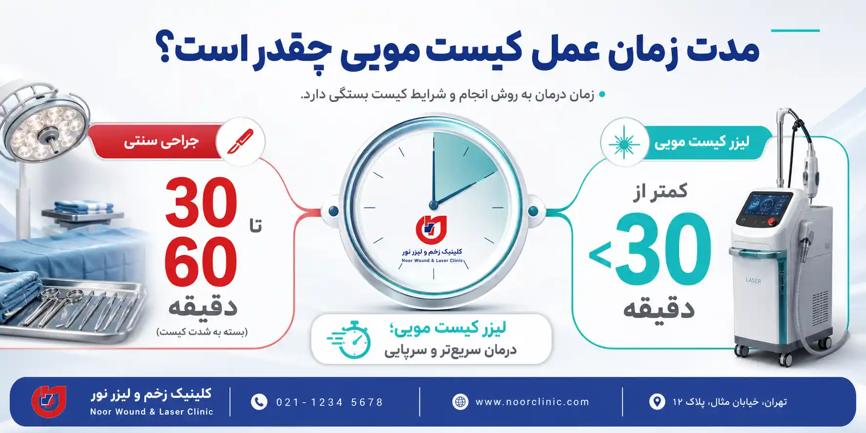 مدت زمان انواع عمل کیست مویی