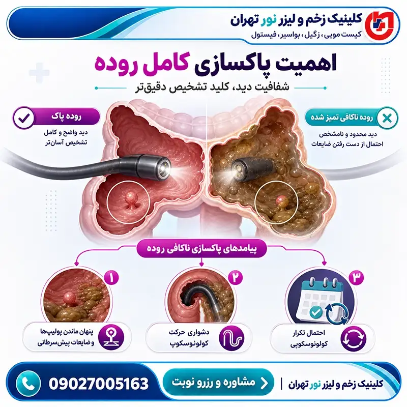 اهمیت پاکسازی کامل روده پیش از کولونوسکوپی برای افزایش وضوح دید پزشک و تشخیص دقیقتر بیماریها