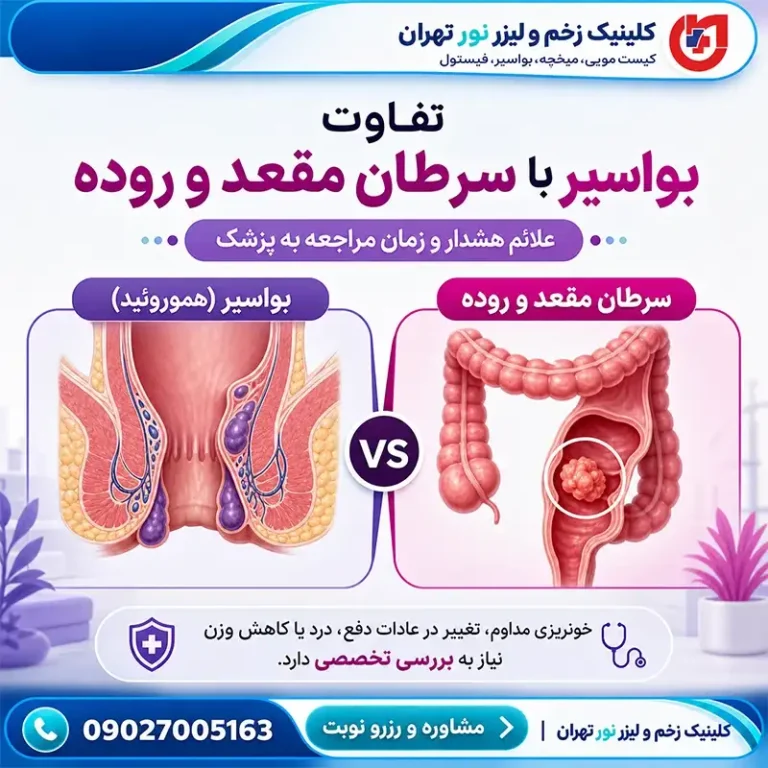 تفاوت بواسیر با سرطان مقعد و روده