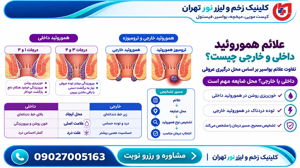 علائم اختصاصی هموروئید داخلی و خارجی
