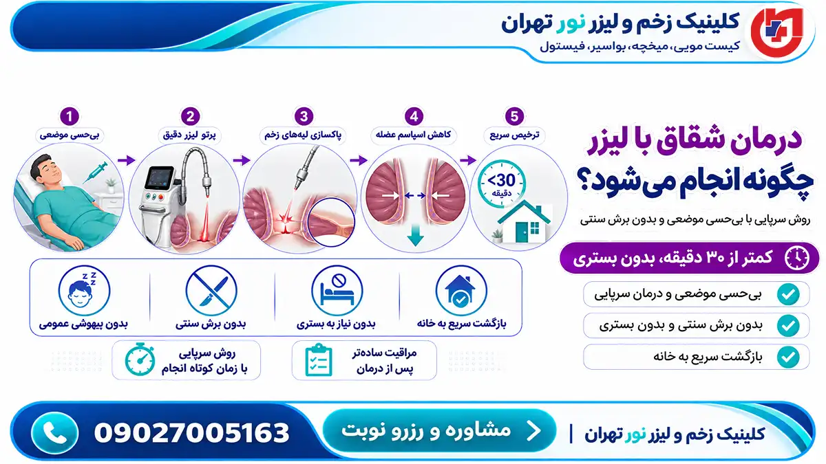 درمان شقاق مقعدی با لیزر به روش سرپایی بدون بیهوشی و جراحی