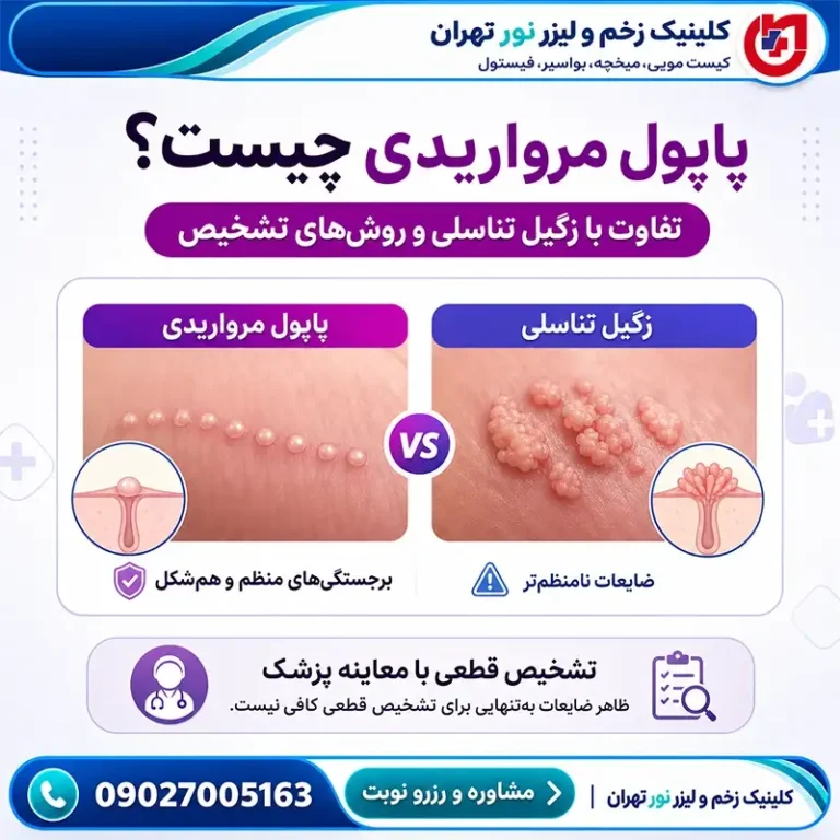 پاپول مرواریدی چیست؟ تشخیص، تفاوت با زگیل تناسلی و درمان