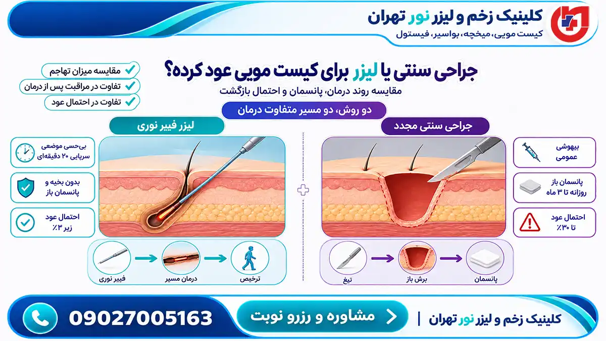 مقایسه روش لیزر فیبر نوری با جراحی سنتی در درمان کیست مویی عود کرده - کلینیک نور