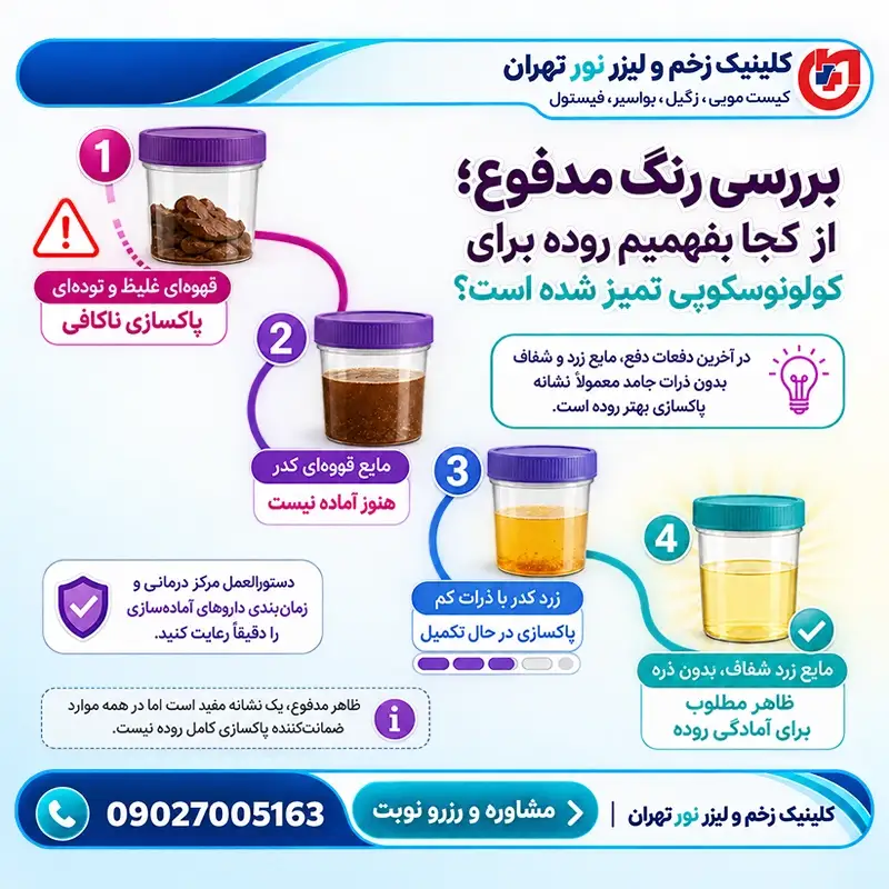 بررسی رنگ و شفافیت مدفوع برای تشخیص پاکسازی کامل روده پیش از کولونوسکوپی